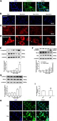 PKC-ζ Aggravates Doxorubicin-Induced Cardiotoxicity by Inhibiting Wnt/β-Catenin Signaling